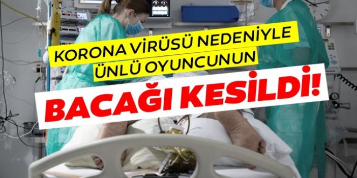 Ünlü oyuncunun koronavirüsden bacağı kesildi